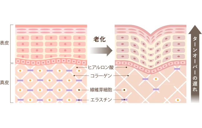 肌の老化が起こる原因の図解