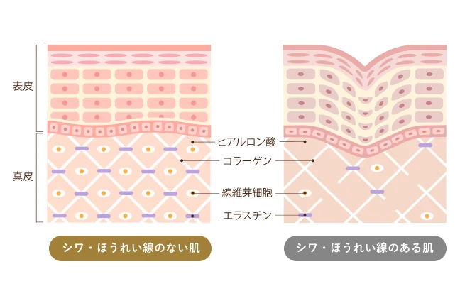 シワ・ほうれい線ができる原因の図解