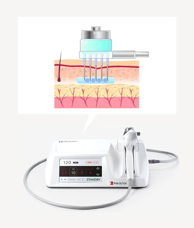 水光注射 施術機器 NEURAJET PLUS